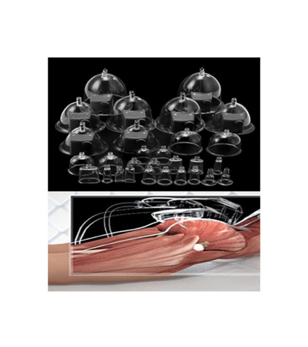 DISPOSITIF VACCUM BRESILIEN – Image 2