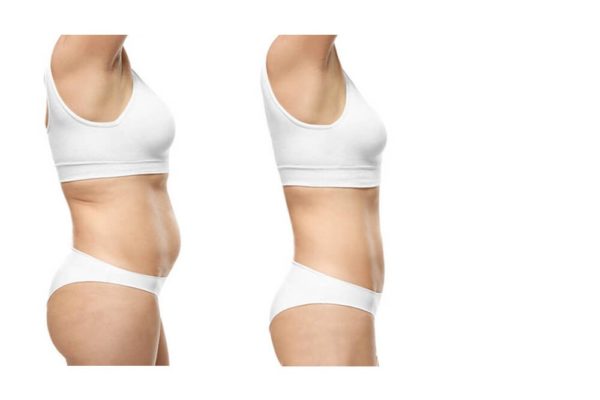 Lipocavitation 6 en 1 – Image 4