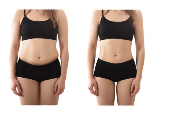Lipocavitation 6 en 1 – Image 3