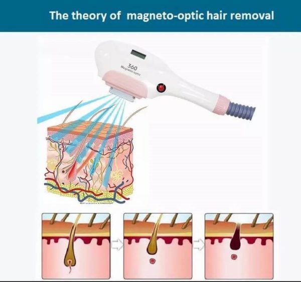 IPL 360 Magnéto Optique OPT SHR – Image 3